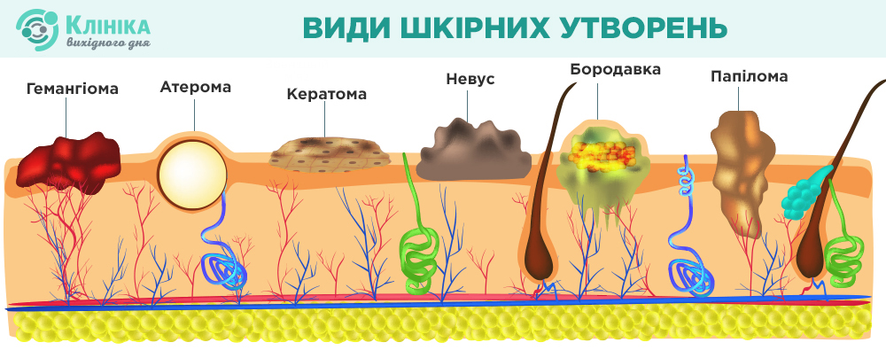 види.jpg