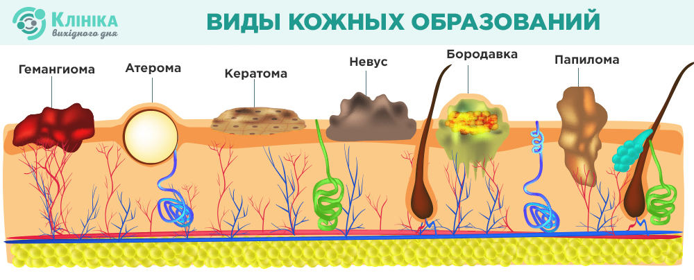 виды.jpg