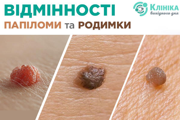 відмінності.jpg