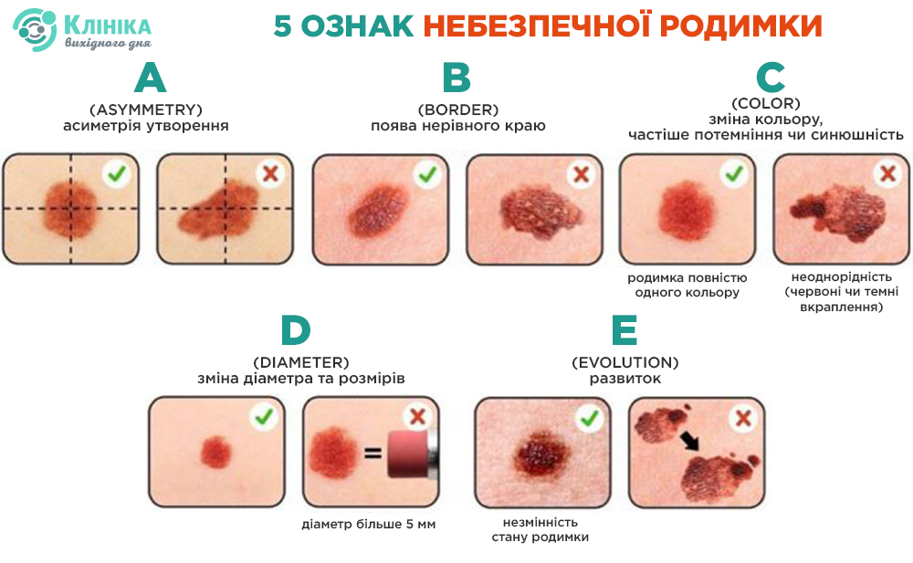 ознаки.jpg