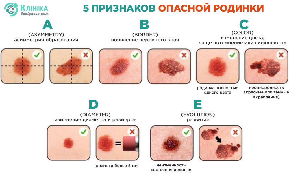 признаки.jpg