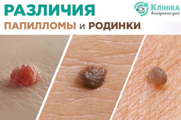 различия.jpg