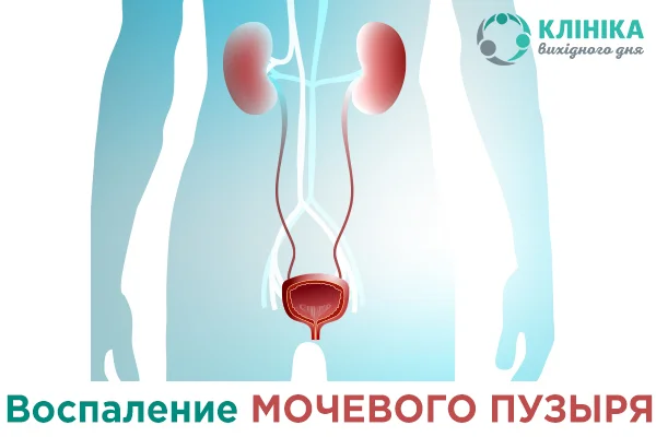 Цистит у детей ⛑ симптомы, диагностика и лечение детского цистита | malino-v.ru