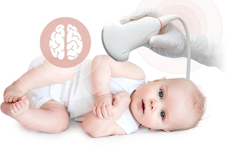 Як часто можна робити УЗД головного мозку новонародженому?