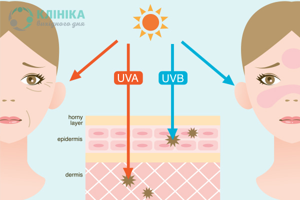 Як захистити шкіру від ультрафіолету і чому надлишкова засмага шкідлива?
