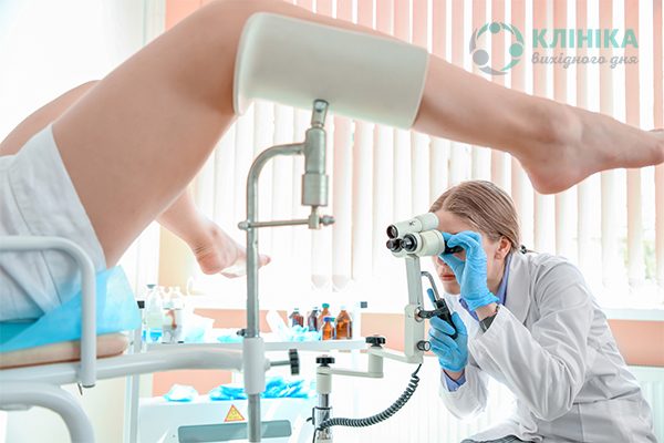  Кольпоскопія та огляд у гінеколога: як часто необхідно відвідувати лікаря і здавати аналізи?